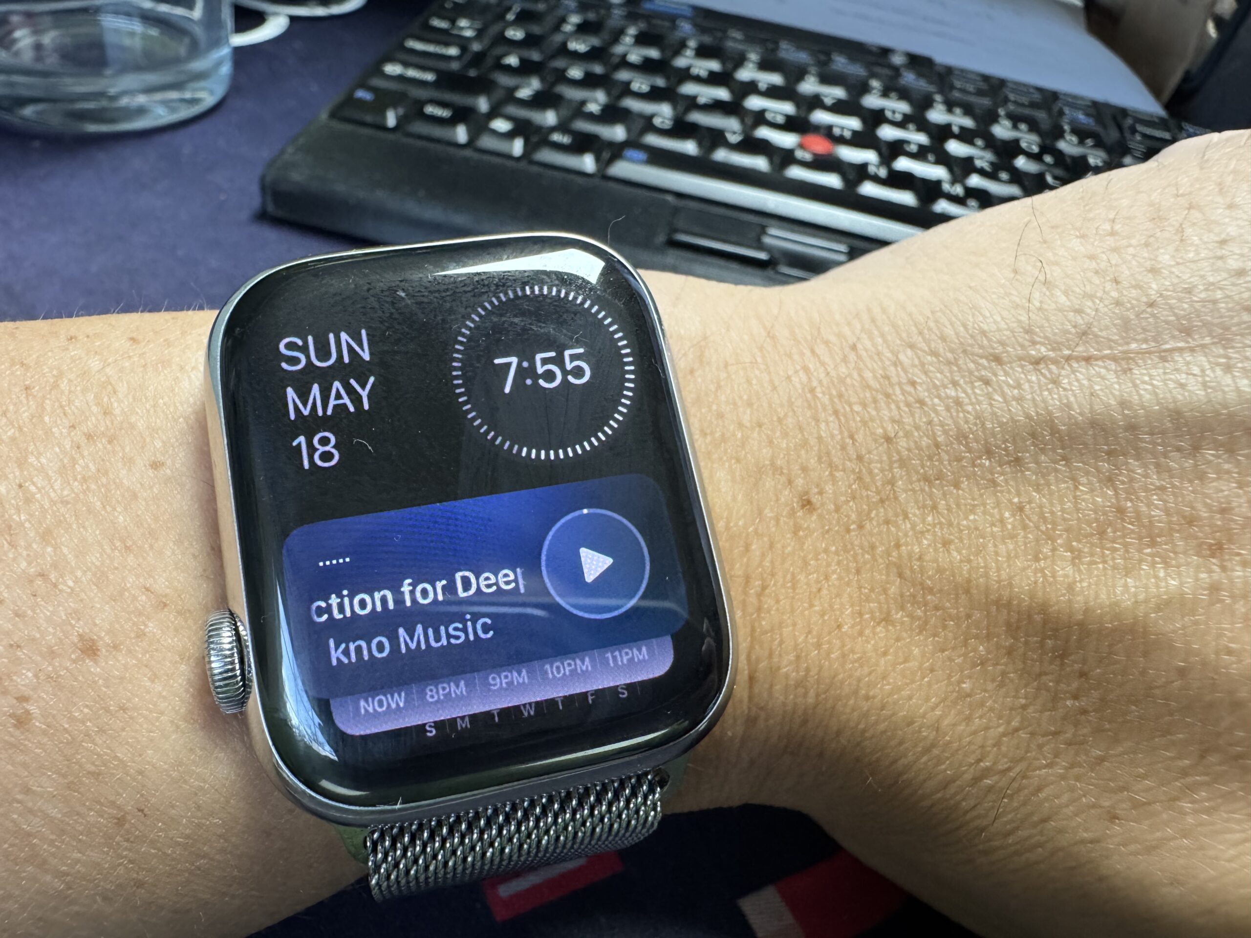 How to Turn Off the “Now Playing” Screen on Your Apple Watch